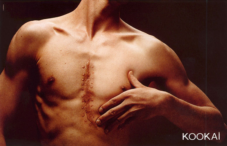 Publicité Kookaï - couleurs - 2000 - Cicatrice