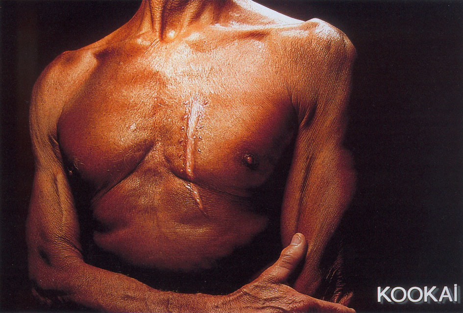 Publicité Kookaï - couleurs - 2000 - Cicatrice