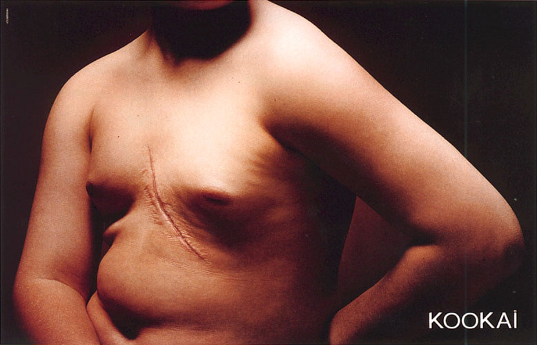 Publicité Kookaï - couleurs - 2000 - Cicatrice