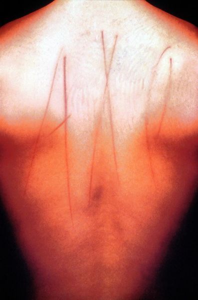 Publicité Axe - Absence de packaging - Homme torse nu avec des griffures dans le dos – Agence  Lowe Porta - Santiago - 2003