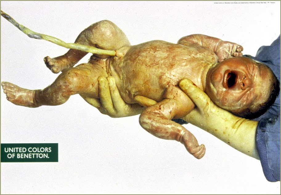 Publicité Benetton - United colors of Benetton — Oliviero Toscani - Enfant venant de naître plein de sang en pleurs - 1991