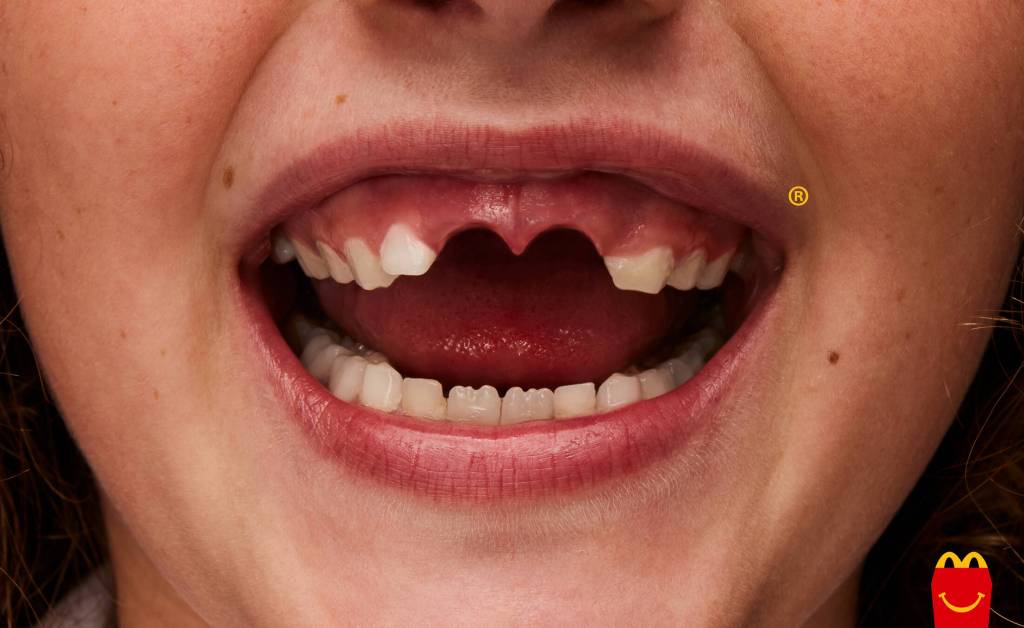 Publicité McDonald's - Happy Meal -Sourire d'un enfant auquel il manque deux dents, dont la disparition forme le M - Agence TBWA\Buenos Aires - 2024