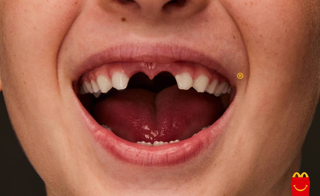 Publicité McDonald's - Happy Meal -Sourire d'un enfant auquel il manque deux dents, dont la disparition forme le M - Agence TBWA\Buenos Aires - 2024